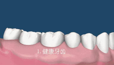 ΢ͼƬ_20200413151008.gif